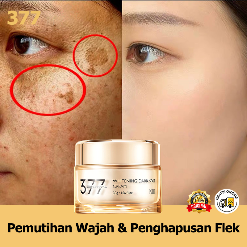 Krim penghilang flek hitam Cream flek Cream pemutih wajah 30g 7X Niacinamide Pemutih Anti-penuaan Wh