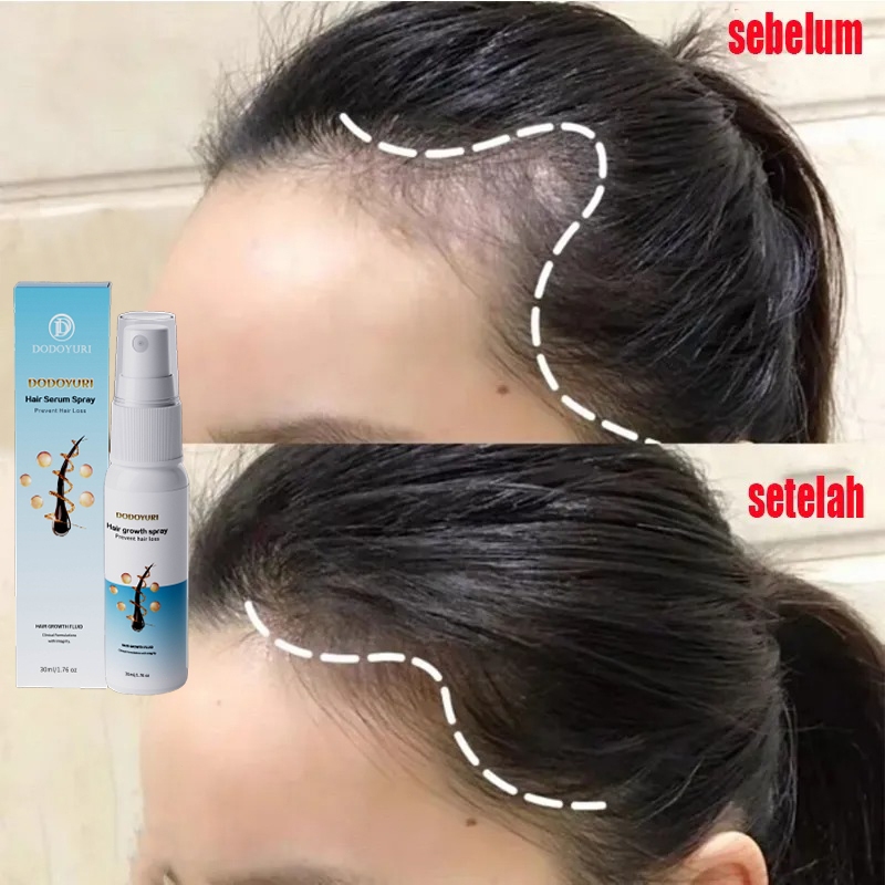 Penumbuh rambut botak penebal rambut penumbuh rambut cepat serum penumbuh rambut 30ml serum rambut r