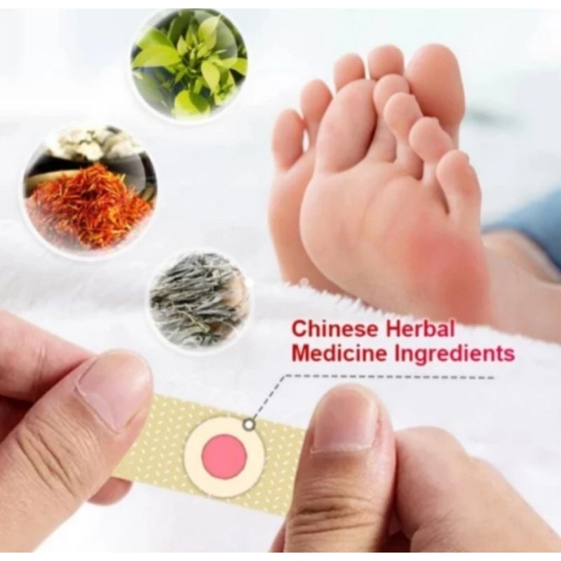 Plester Mata Ikan Penghilang Kutil Kapalan Foot