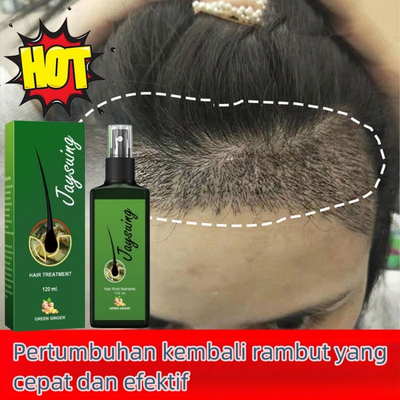 Semprotan Penumbuh Rambut Hair growth serum Penumbuh Rambut Botak hair serum rambut rontok hair loss