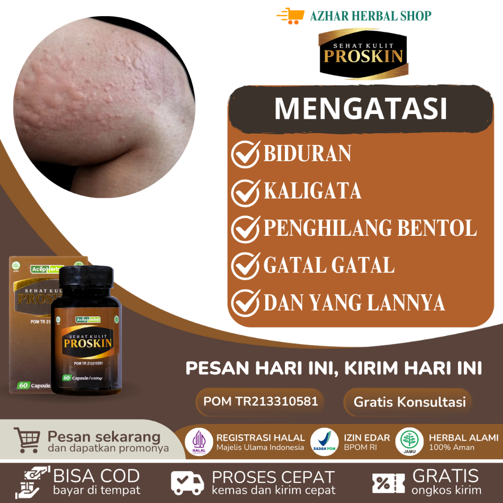 Proskin - Obat Gatal Kulit Alergi Dingin Penghilang Bentol Gatel Alergi Kaligata Biduran