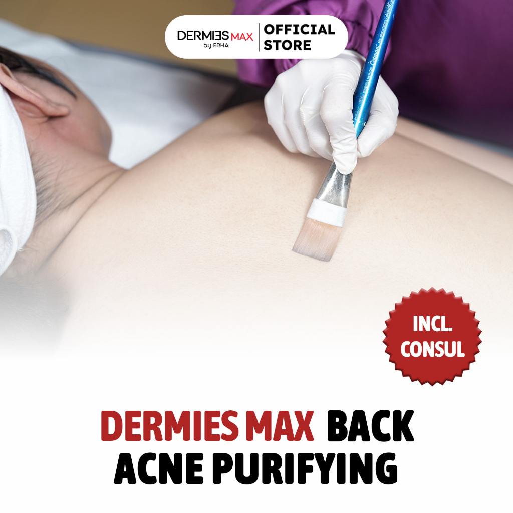 Dermies Max Back Acne Purifying