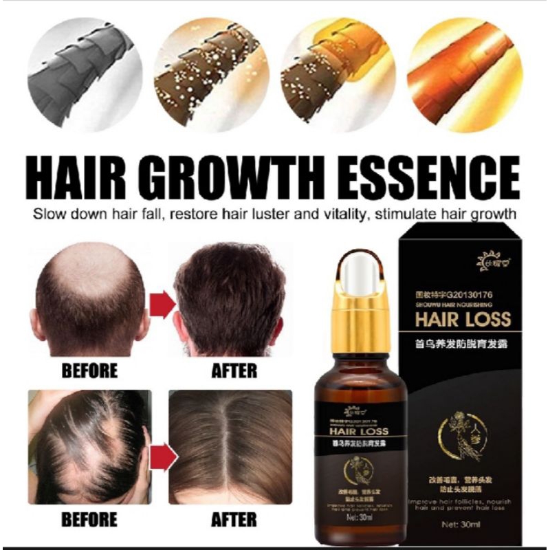 Penumbuh Rambut Botak - Serum Penumbuh Rambut - Hair Growth / Hair Tonic / Serum Penumbuh Rambut Bot