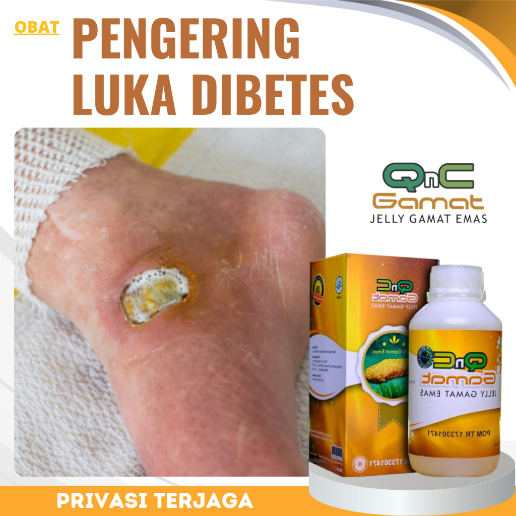 Obat Luka Diabetes, Obat Pengering Luka Diabetes, Obat Luka Diabetes Basah Bernanah, Obat Luka Diabe