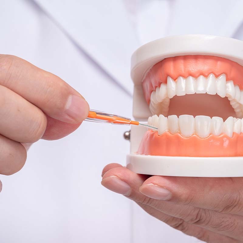 Model Gigi Edukasi Phantom Gigi Lepas Pasang Pvc Alat Peraga Gigi dental model