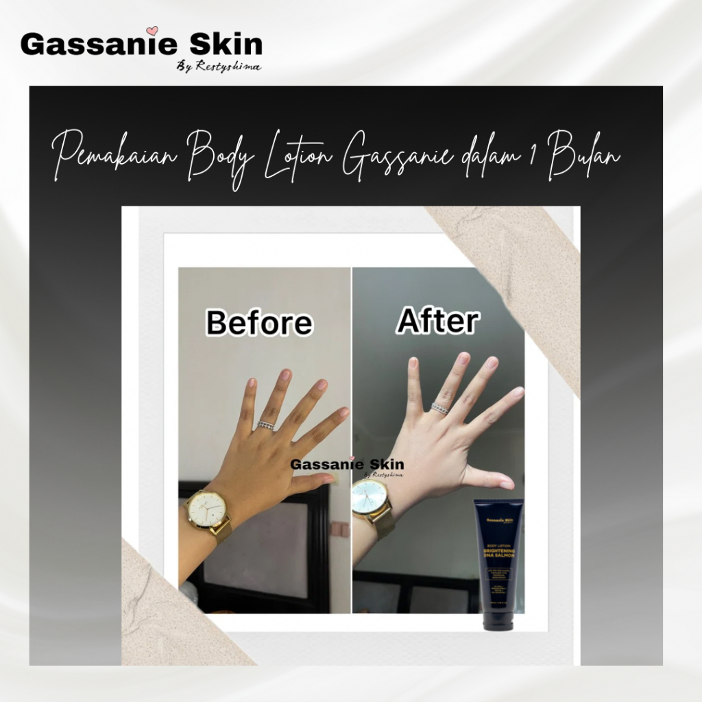 Gassanie Skin 5 pcs Body Lotion Brightening DNA Salmon Pencerah Kulit Kusam & Sensitif By RestyShima