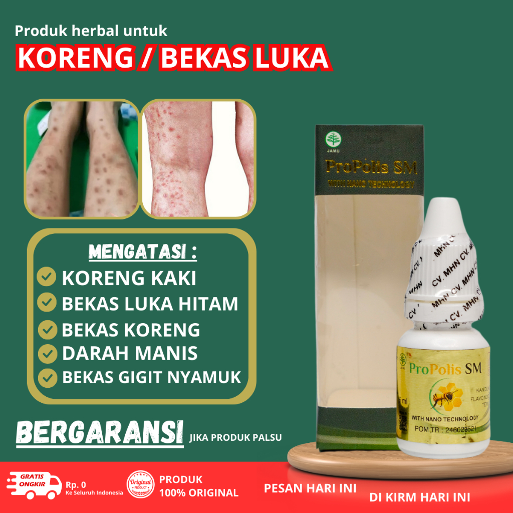 Obat Darah Manis - Obat Amis Daging Gatal - Obat Korengan di kaki - Obat Borok / Budug di kaki