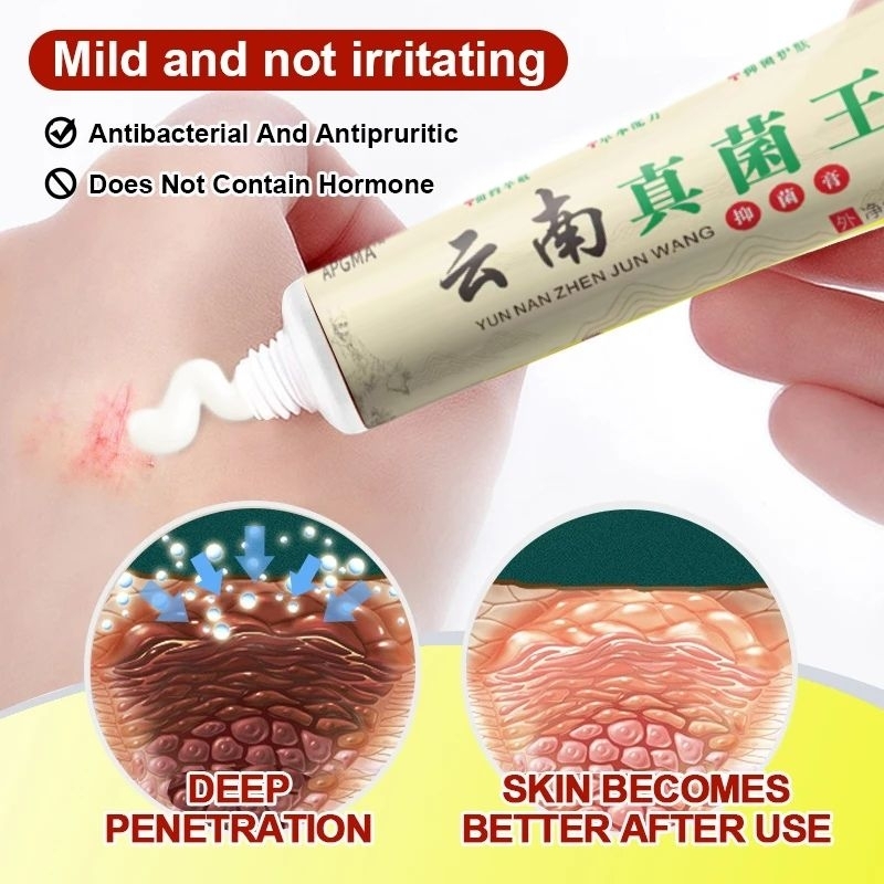 Salep Yunnan Krim Hijau Obat Kulit Gatal Salep Ruam Jamur Kudis Kurap Alergi Bakteri Jamur PICC Orig