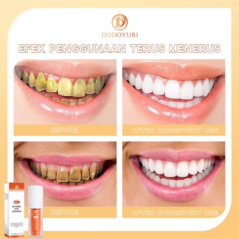 Odol pemutih gigi dan karang gigi penghilang karang gigi perontok karang gigi paling ampuh 30ml