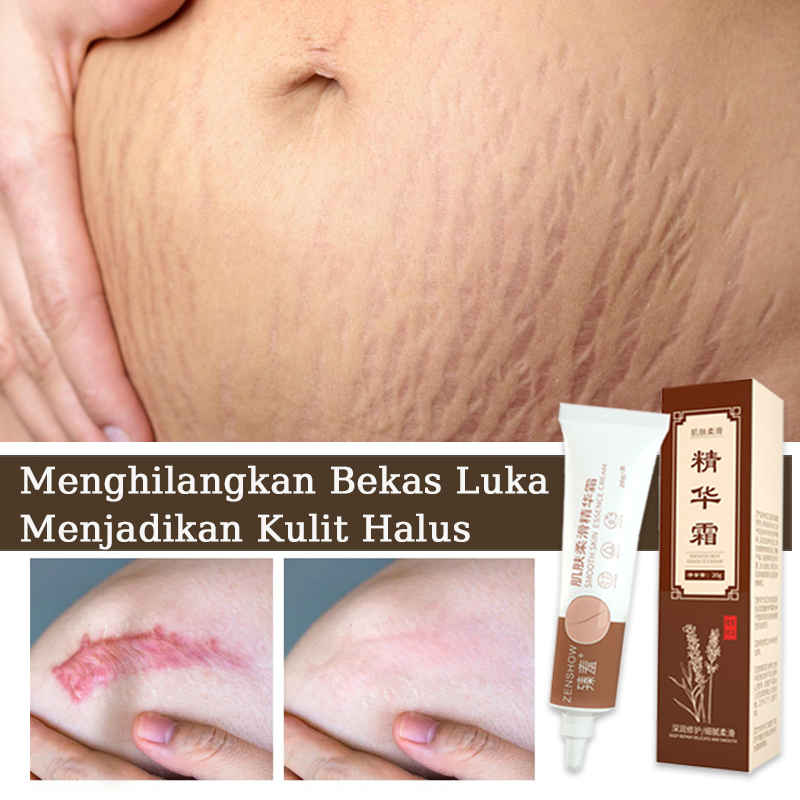 Penghilang bekas luka Salep penghilang bekas luka Penghilang bekas luka hitam Menghilangkan bekas lu
