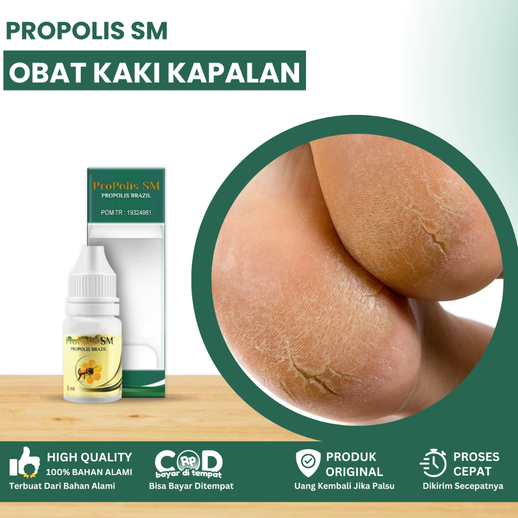 Obat Kulit Kapalan, Obat Kapalan Di Telapak Kaki, Obat Kaki Kapalan, Obat Kulit Mengeras, Obat Kulit