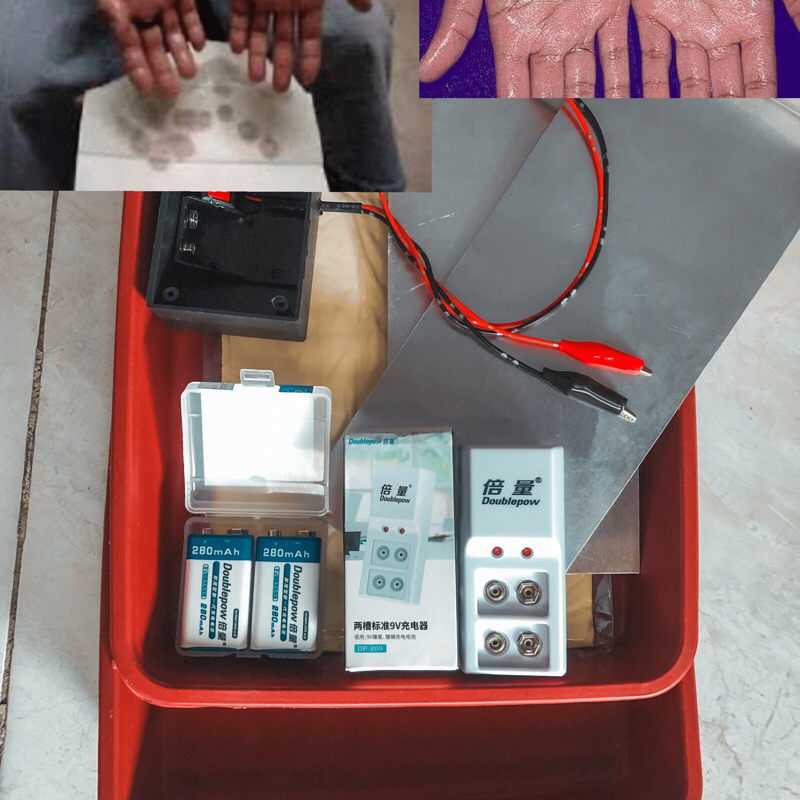 PPGshop alat terapi keringat berlebih (tangan & kaki),iontophoresis