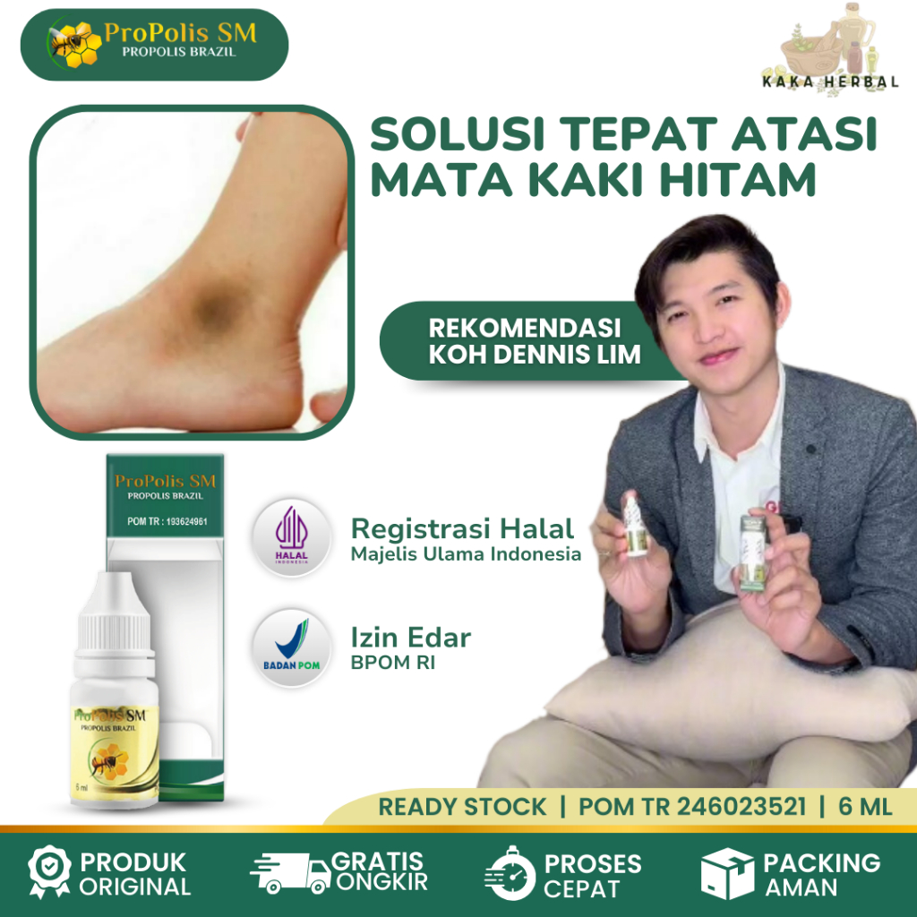 Kaka Herbal - Obat Mata Kaki Hitam, Obat Mata Kaki Bengkak Kering Hitam, Obat Benjolan Di Kaki, Obat