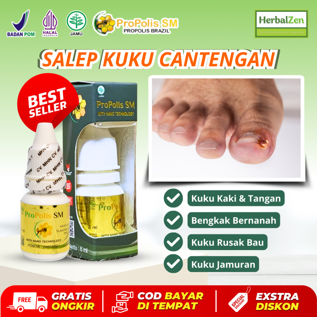 Salep Kuku Cantengan Jempol Kuku Kaki Tangan Bengkak Bernanah Rusak Bau Kuku Jamuran Propolis SM