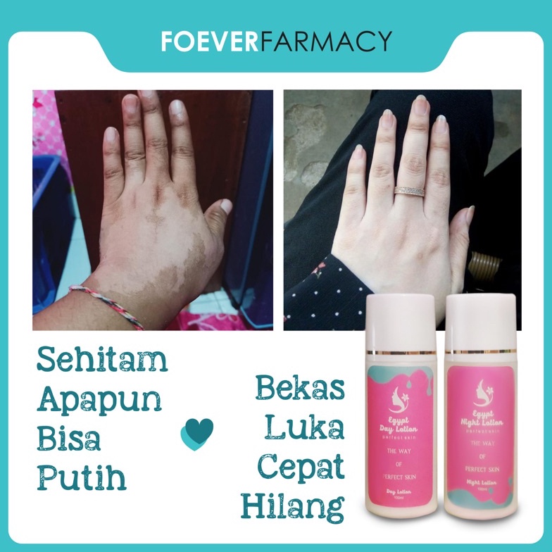 KODE L6R LOTION PEMUTIH PAGI  MALAM  EGYPT WHITE