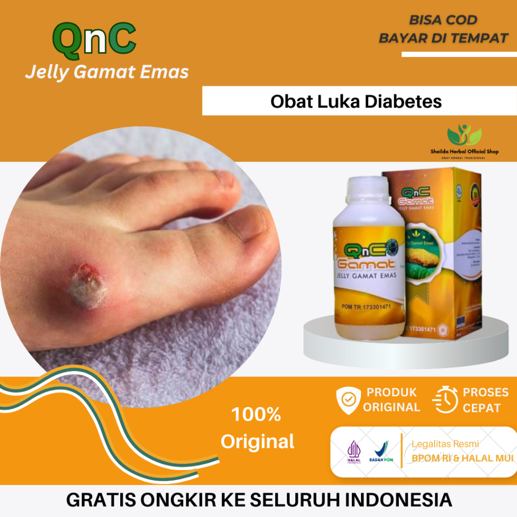 Obat Pengering Luka Diabetes, Luka Diabetes Di Kaki Bolong, Luka Diabetes Di Telapak Kaki, Obat Kaki