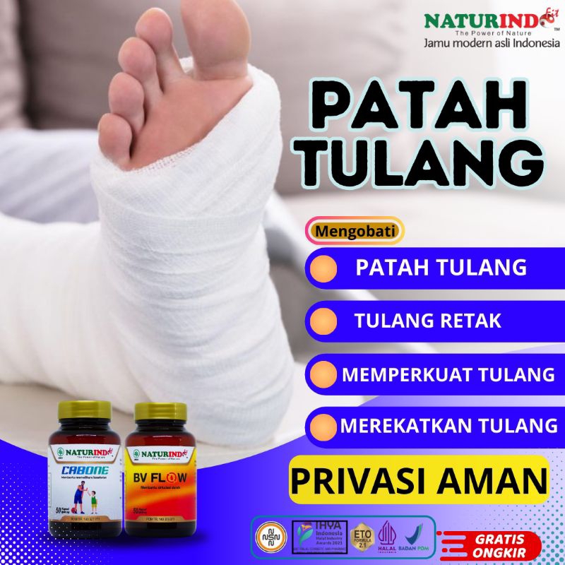 Obat Patah Tulang Tulang Retak Kalsium dan Nutrisi Tulang Obat Penguat Tulang