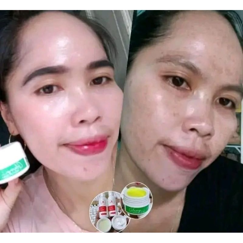 salep flek hitam maxie original