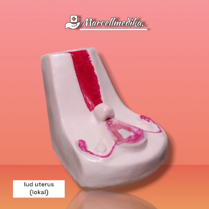 PHANTOM MANEKIN IUD UTERUS / MANIKIN UTERUS