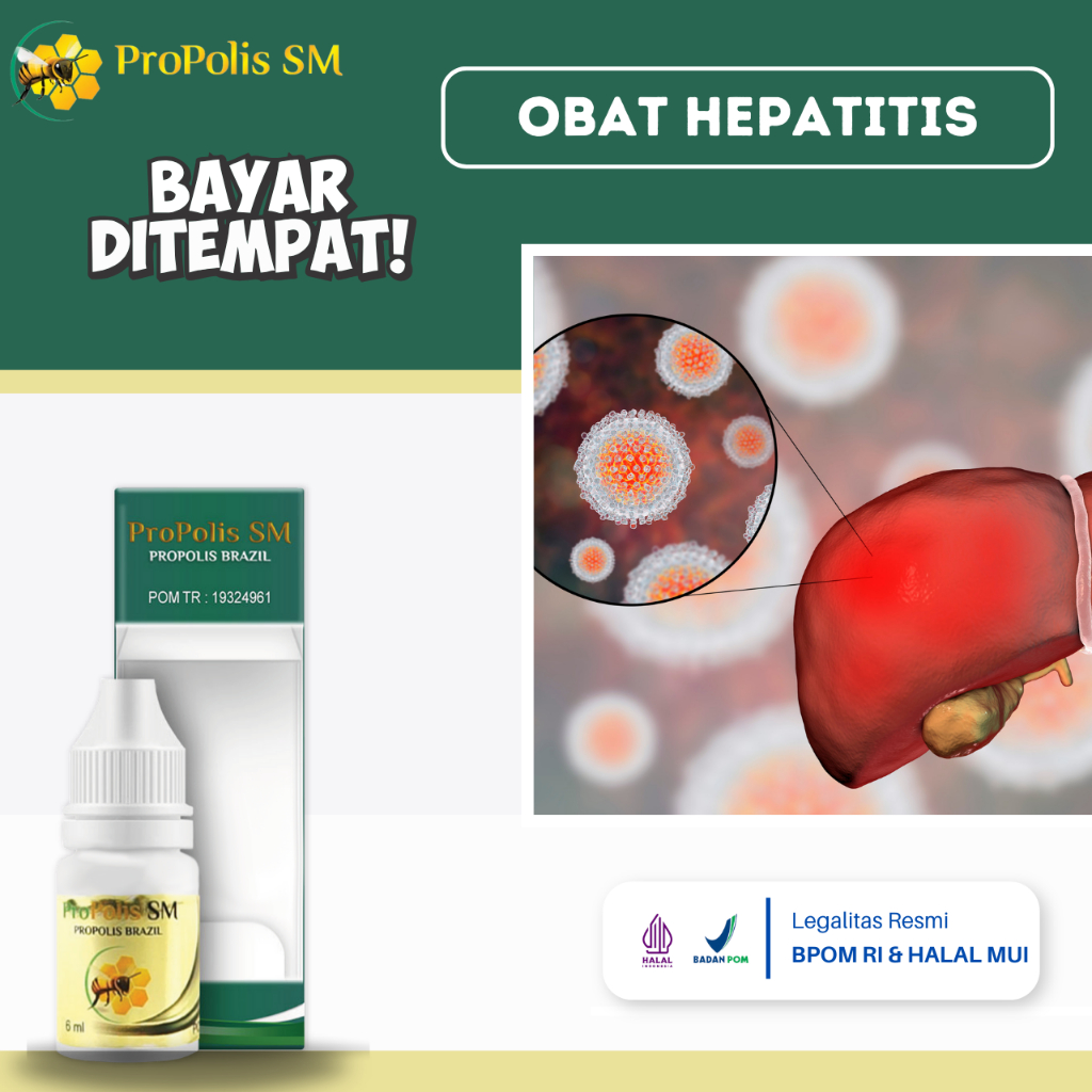 Obat Hepatitis, Obat Hepatitis Akut, Obat Hepatitis Kronis, Obat Liver, Obat Liver Perut Bengkak, Ob