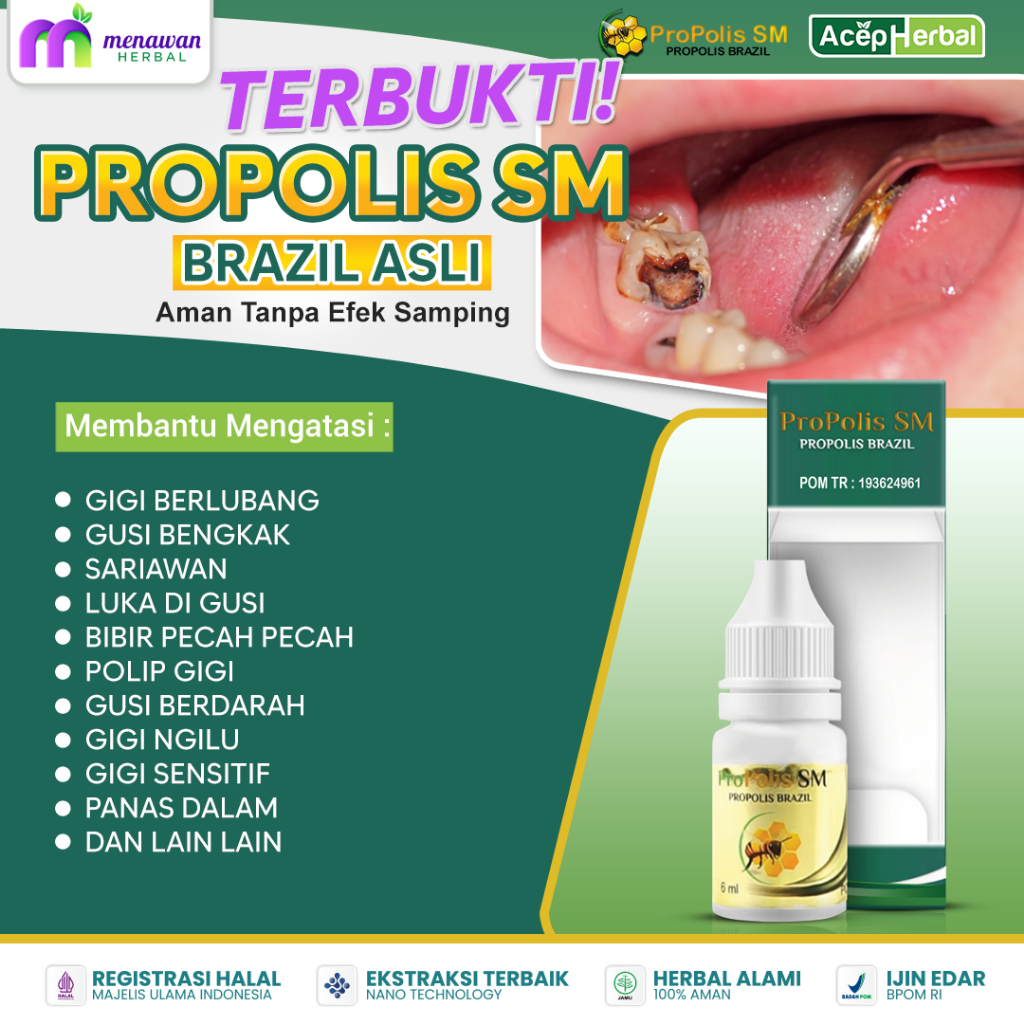 Obat sakit gigi berlubang sakit gusi gigi berdarah gusi bengkak gusi turun propolis sm