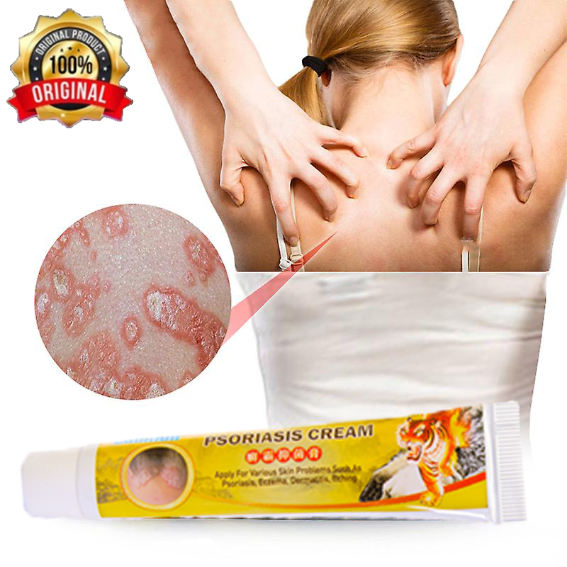 salap gatal kulit yang ampuh salep kadas kurap gatal ampuh salep panu paling ampuh 100% Menghilangka