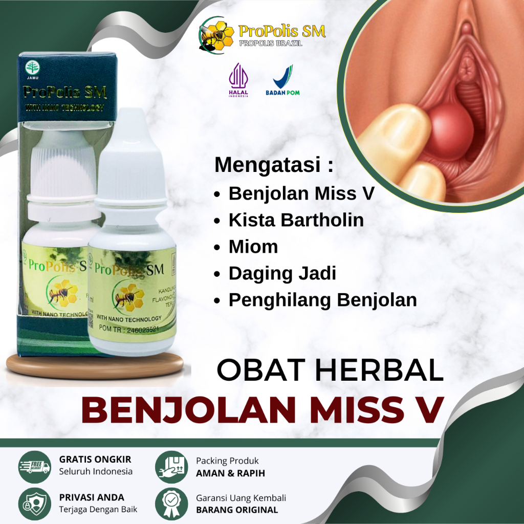Obat Benjolan di Miss V, Obat Benjolan Daging Jadi, Obat Kista Bartholin, Obat Kista Ovarium, Obat K
