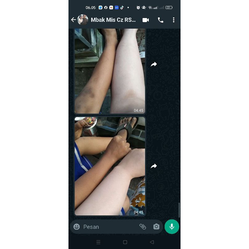 ECER LOTION R SKINCARE FASTER WHITENING