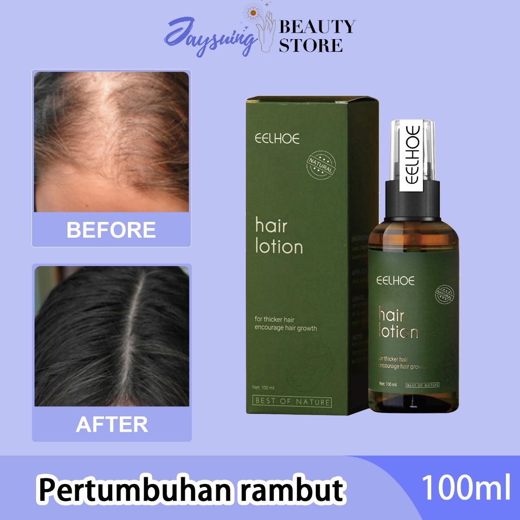 EELHOE Pertumbuhan rambut  100ml/Rosemary Oil penumbuh rambut pelebat rambut penumbuh rambut botak p