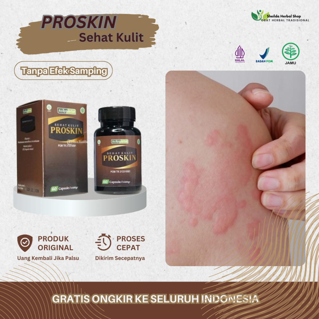 Proskin Gatal Kulit Biduran, Alergi Dingin, Gatal Seluruh Tubuh, Bentol Di Kulit, Biduran Menahun