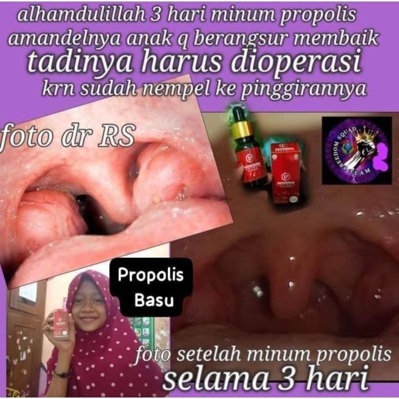 

propolis basu 1botol 50.000