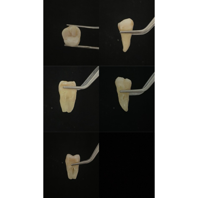 Gigi Asli Molar Rahang Atas Gigi Praktikum Molar