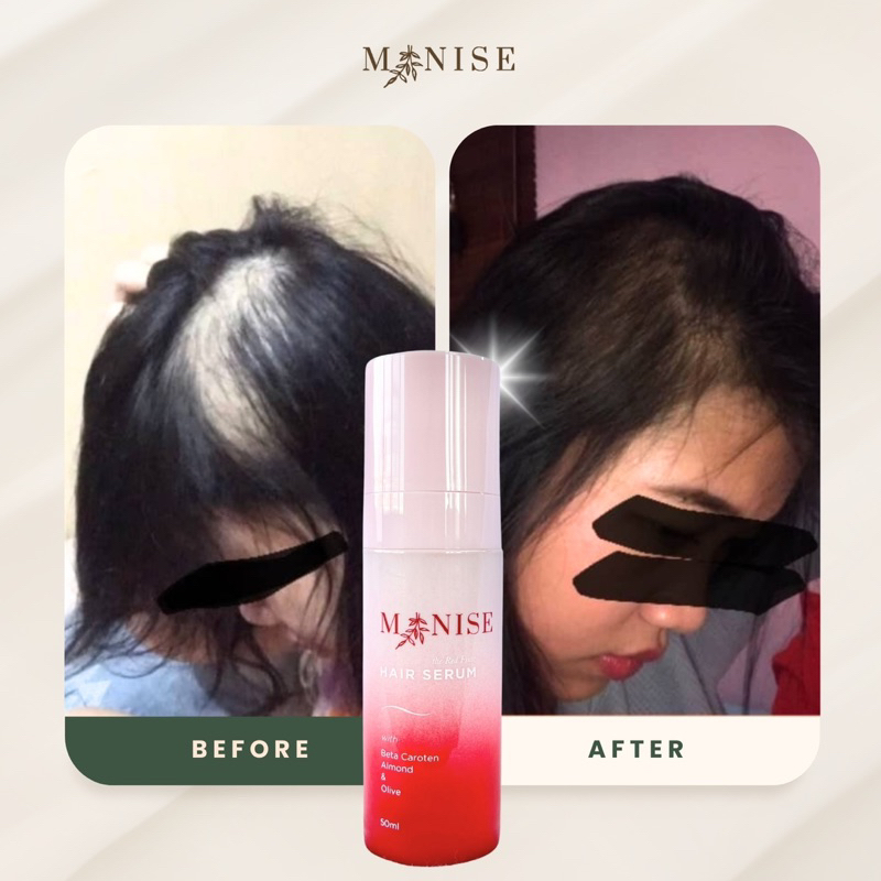 Manise Hair Oil Dewasa Baby minyak Rambut Kemiri Anti Rontok Botak Gondrong