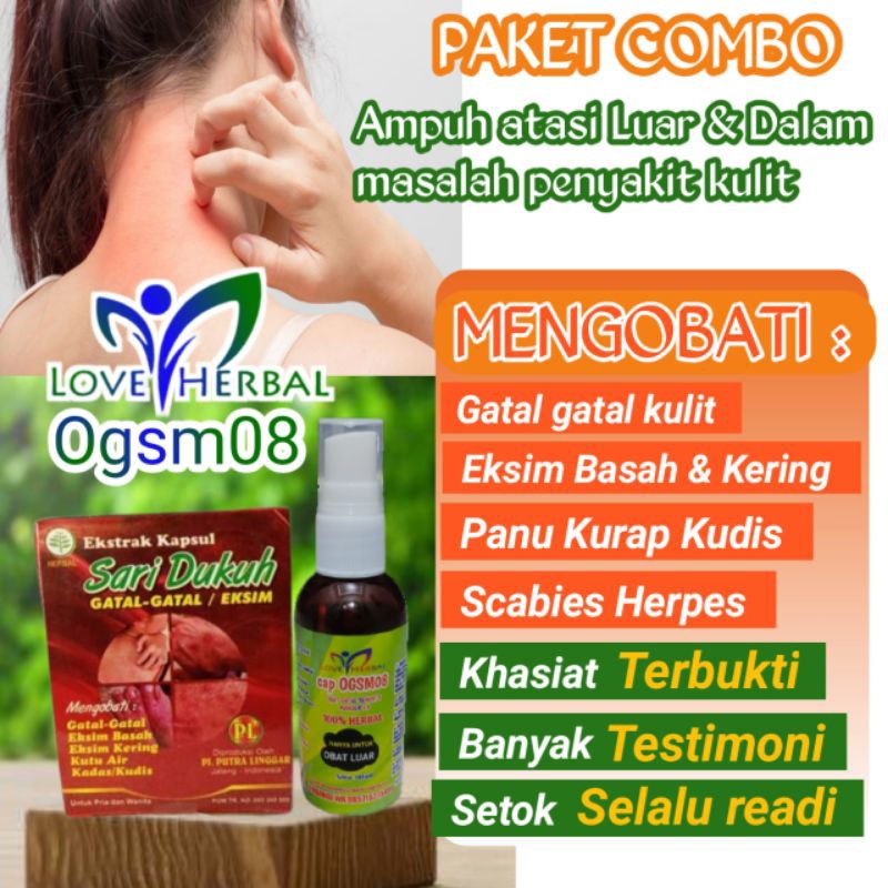 obat gatal kulit eksim paling ampuh