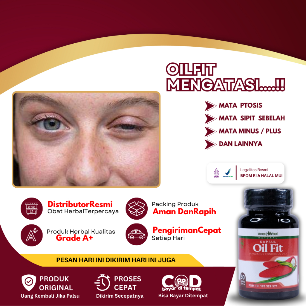 Obat Mata Ptosis Lipatan Kelopak Mata Beda Sebelah, Mata Sipit Sebelah, Kelopak Mata Turun,  Mata Se