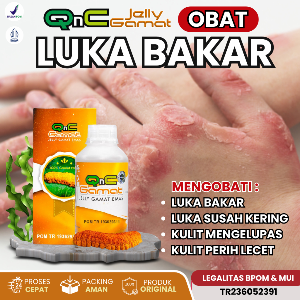 Obat Luka Bakar Obat Oles Pengering Luka Bakar Obat Luka susah Kering Obat Kulit Mengelupas Obat Kul