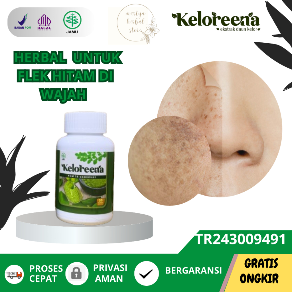 Keloreena Obat Herbal Untuk Flek Hitam Obat Noda Hitam di Wajah Obat Penghilang Bintik Hitam Di Waja