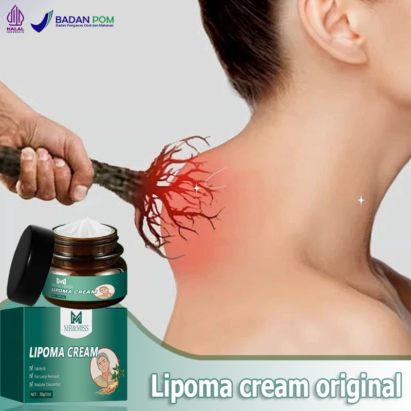 Lipoma cream original Obat benjolan Lipoma removal cream original Obat lipoma Salep lipoma salep ben