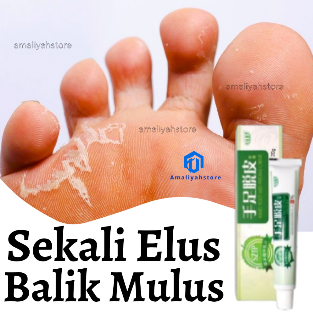 Salep Kaki Rayapan Dan Bau Obat Jamur Krim Untuk Telapak Kaki Gatal Kutu Air Kapalan Bolong Pecah