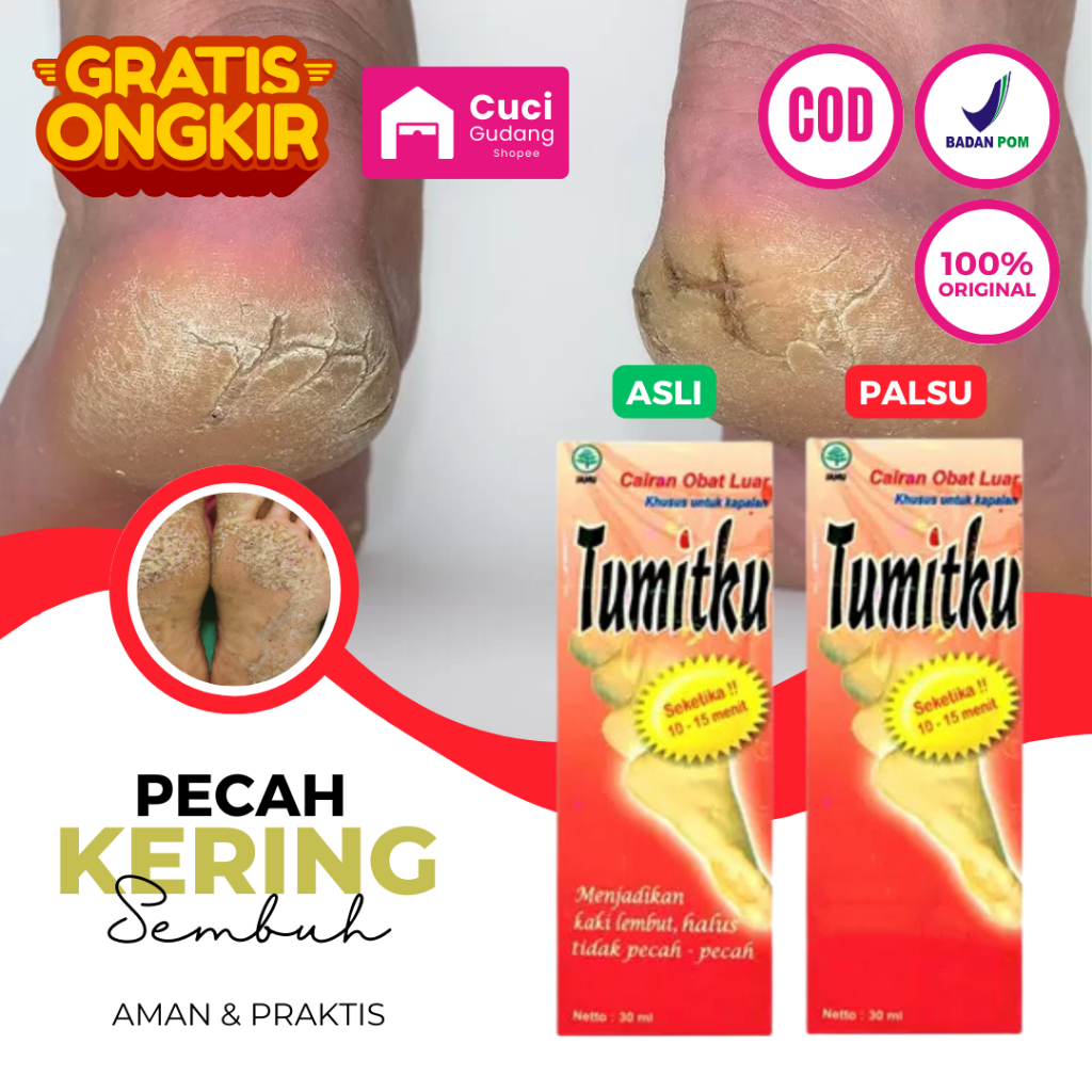 Obat Tumit Pecah Dan Kering - Salep Kaki Pecah Dan Kering Ampuh Pembersih Kaki Pecah Dan Kering Obat