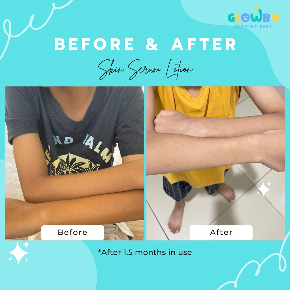 [BPOM Ready Bandung] Glowby Sabun Pemutih dan Pencerah Kulit Bayi Anak