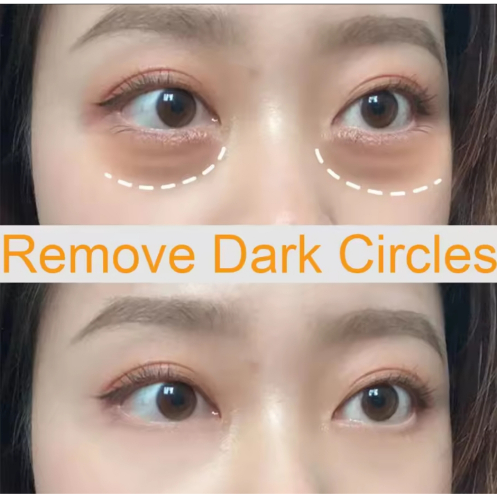 ORI 100% Krim Mata Panda dan Keriput - VHA Caviar Moist And Tight Eye Cream / Wonder Eye Cream Anti-