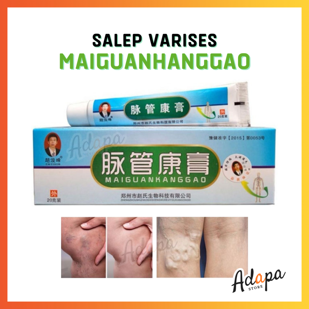 ❤ ADAPA ❤ Salep Varises Maiguankanggao 100%  Original / Obat Herbal Krim Salep China Penghilang Vari