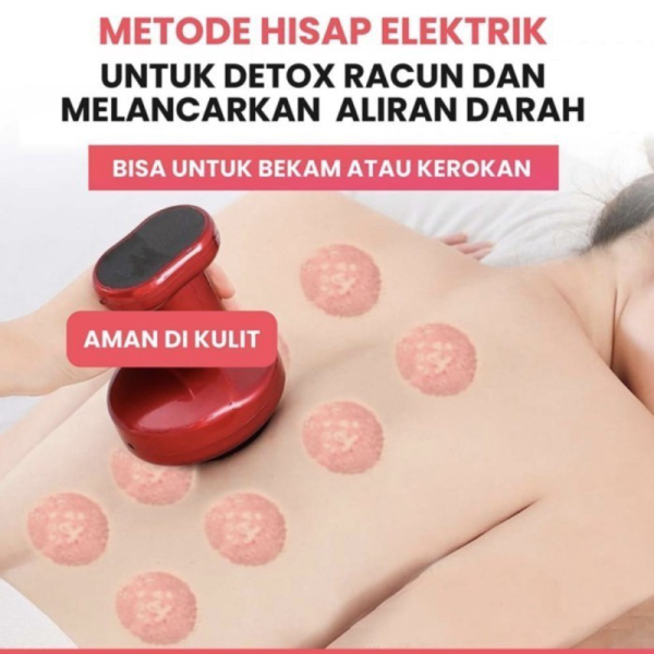 Dijual SMART CUPPING MASSAGER ORIGINAL Berkualitas