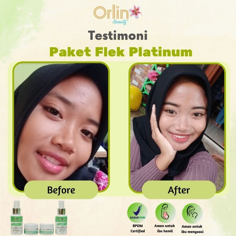 flek platinum Orlin Beauty