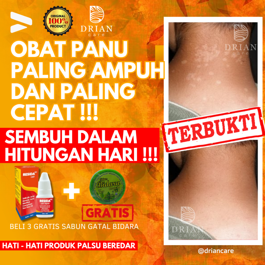 Obat Panu Paling Ampuh 100% Obat Gatel Gatal Kadas Kurap Jamur Kutu Air Eksim Paling Ampuh Obat Gata