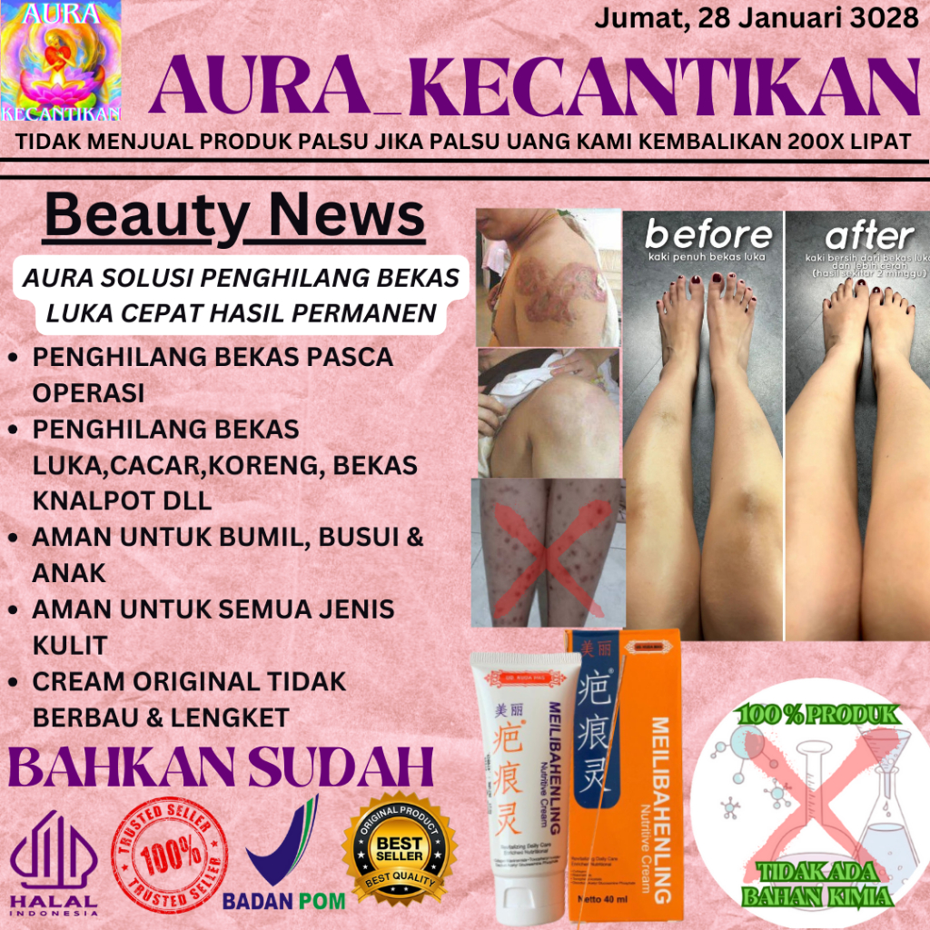 PENGHILANG BEKAS LUKA MEILIBAHENLING ORIGINAL BPOM - MEILIBAHENLING CREAM ORIGINAL BPOM