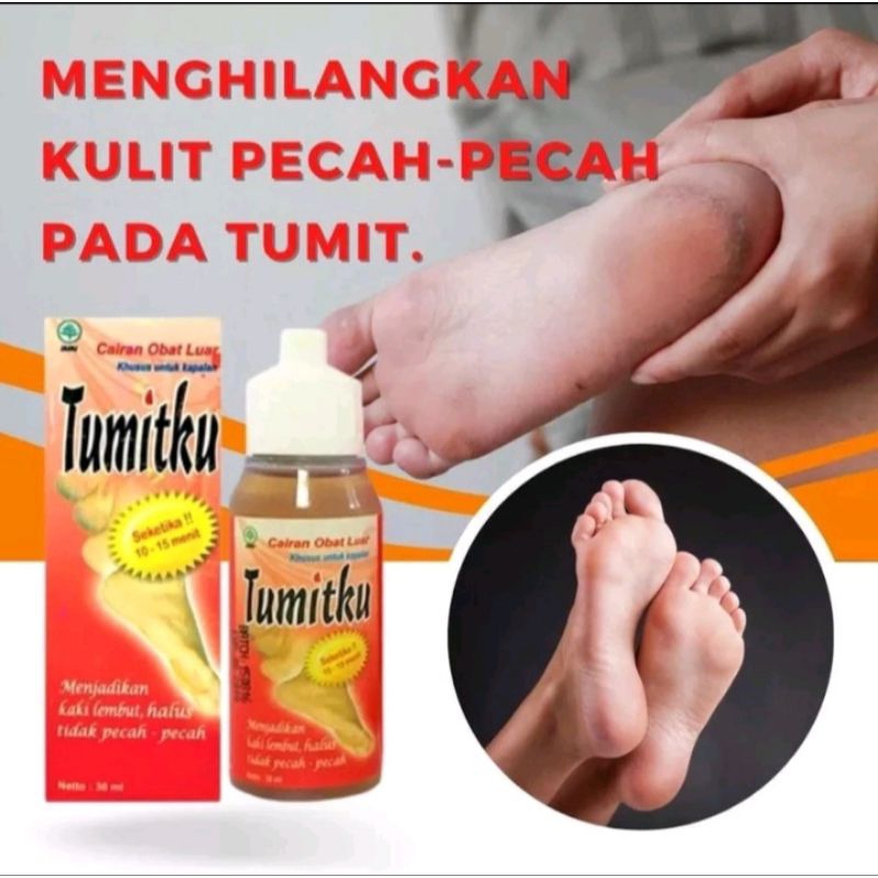 TUMITKU / OBAT PENGHILANG TUMIT KAKI PECAH-PECAH