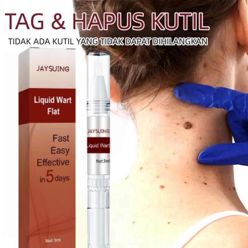 Penghilang kutil wart remover pen Penghilang Tahi Lalat Penghilang Kutil Skin Tag Remover Menghilangkan Tahi Lalat