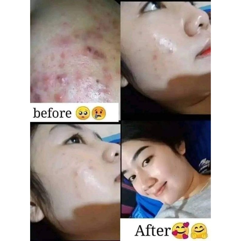 R dan D glow skincare